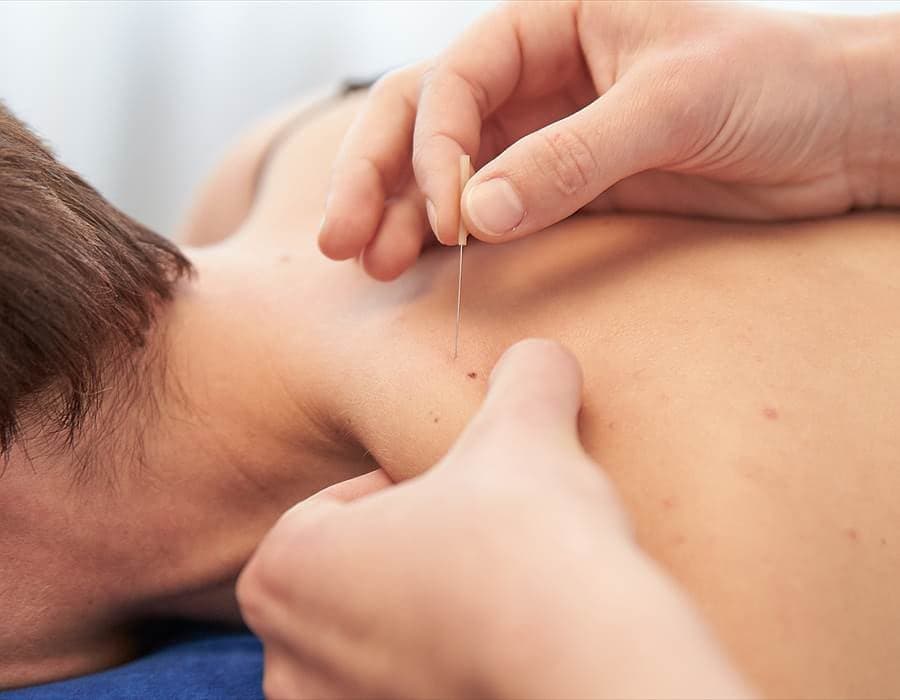 Dry needling: λεπτή βελόνα στους μύες του ώμου
